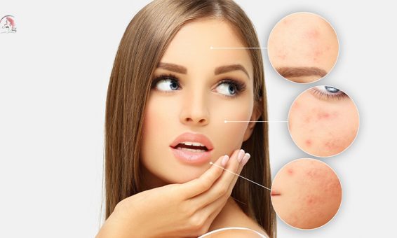 Serum trị thâm mụn và quy trình chăm sóc da