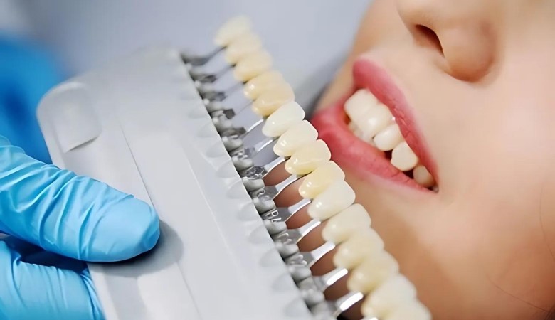 Nên bọc răng sứ loại nào cho phù hợp Nên bọc răng sứ loại nào cho phù hợp